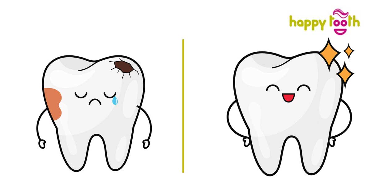 Συμβουλές στοματικής υγείας από το HappyTooth